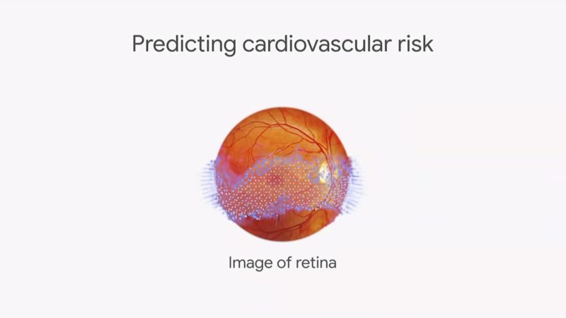 Google AI Levels Up Retinal Scans